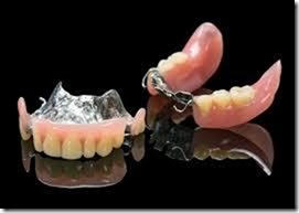 金属床義歯の仕組み