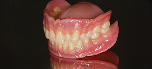 イボカップ義歯の仕組み